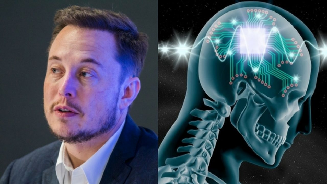 Elon Musk: Projeto da Neuralink de implantar chip no cérebro preocupa cientistas