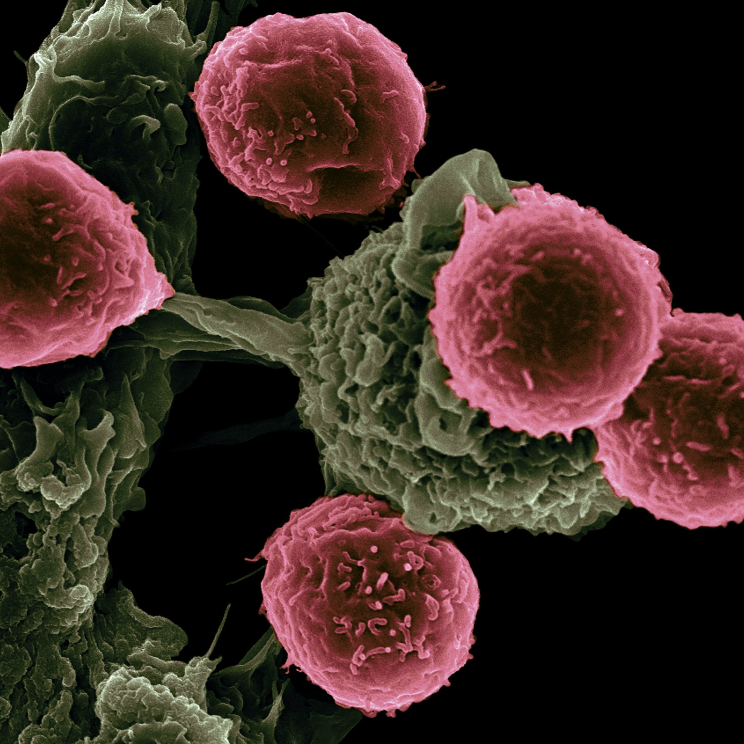 Motivo para o ser humano ter câncer é descoberto por cientistas Motivo para o ser humano ter câncer é descoberto por cientistas